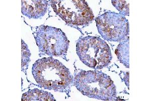 IHC analysis of Epigen using anti-Epigen antibody (ABIN5518911).