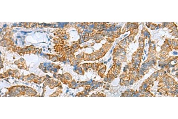 FBXO8 antibody