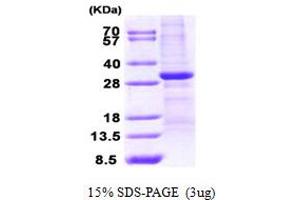 SDS-PAGE (SDS) image for WW Domain Containing Oxidoreductase (WWOX) (AA 1-234) protein (His tag) (ABIN7278826) (WWOX Protein (AA 1-234) (His tag))