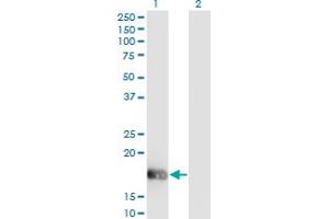 Western Blot analysis of OMP expression in transfected 293T cell line by OMP monoclonal antibody (M01), clone 2B7. (OMP antibody  (AA 65-163))