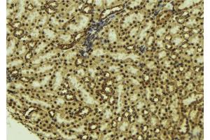 ABIN6277183 at 1/100 staining Mouse kidney tissue by IHC-P. (NADPH Oxidase 4 antibody  (Internal Region))