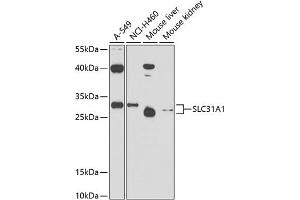 SLC31A1 antibody  (AA 1-60)