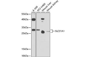 Western blot analysis of extracts of various cell lines, using SLC31 antibody (0109) at 1:1000 dilution. (SLC31A1 antibody  (AA 1-60))