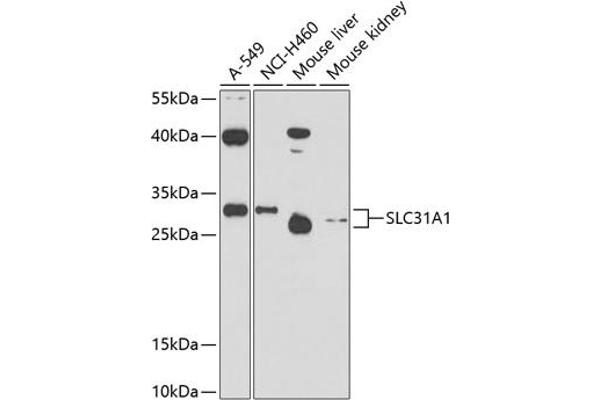 SLC31A1 anticorps  (AA 1-60)