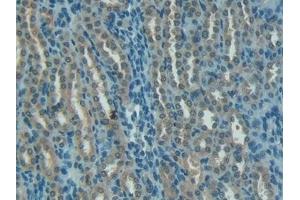 Immunohistochemistry (IHC) image for anti-Serpin Peptidase Inhibitor, Clade G (C1 Inhibitor), Member 1 (SERPING1) (AA 148-270) antibody (ABIN7431434)