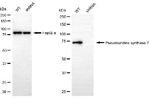 Western blotting analysis using pseudouridine synthase 7 antibody (ABIN7800059). (PUS7 antibody)