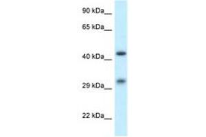 Image no. 1 for anti-Scavenger Receptor Class B, Member 2 (SCARB2) (AA 25-74) antibody (ABIN6749778) (SCARB2 antibody  (AA 25-74))
