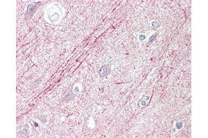 Anti-SLIT1 / SLIT-1 antibody IHC staining of human brain, cortex. (SLIT1 antibody  (AA 84-113))