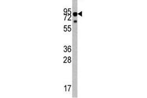 Western blot analysis of TrkA antibody and mouse liver tissue lysate.