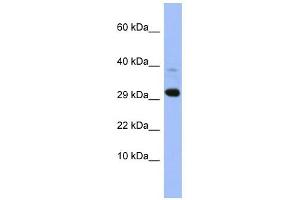 MRPL47 antibody used at 1 ug/ml to detect target protein. (MRPL47 antibody  (Middle Region))