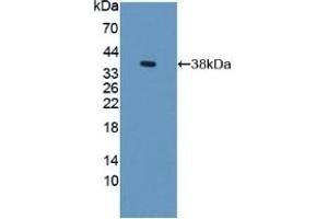 Detection of Recombinant S17aH, Rat using Polyclonal Antibody to Cytochrome P450 17A1 (CYP17A1) (CYP17A1 antibody  (AA 201-507))