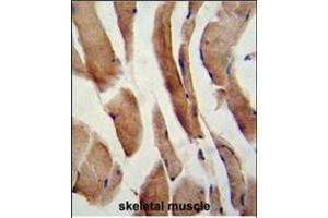Formalin-fixed and paraffin-embedded human skeletal muscle reacted with CFLAR Antibody (Center), which was peroxidase-conjugated to the secondary antibody, followed by DAB staining.