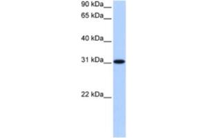 Western Blotting (WB) image for anti-Trinucleotide Repeat Containing 18 (TNRC18) antibody (ABIN2463465)