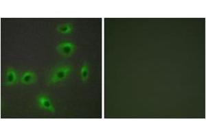 Immunofluorescence analysis of HuvEc cells, using BAX Antibody. (BAX antibody  (AA 41-90))