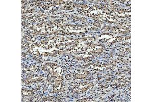 IHC analysis of hnRNP L/HNRNPL using anti-hnRNP L/HNRNPL antibody (ABIN7600130). (HNRNPL antibody  (AA 152-569))