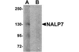 Western blot analysis of NALP7 in human brain tissue lysate with NALP7 antibody at 1 μg/ml in (A) the absence and (B) the presence of blocking peptide.