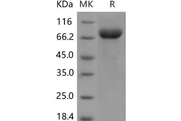 LILRB3 Protein (His tag)