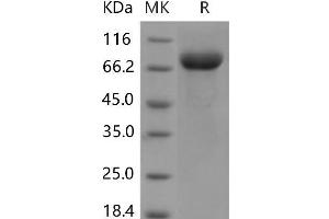 Western Blotting (WB) image for Leukocyte Immunoglobulin-Like Receptor B3 (LILRB3) protein (His tag) (ABIN7320154) (LILRB3 Protein (His tag))