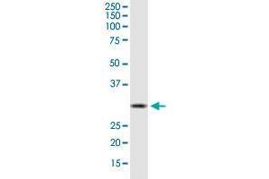 HSD17B12 monoclonal antibody (M08), clone 4G11.