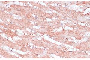 Immunohistochemistry of paraffin-embedded Rat heart using RPL30 Polyclonal Antibody at dilution of 1:100 (40x lens). (RPL30 antibody)