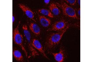 IF analysis of RFTN1 using anti-RFTN1 antibody (ABIN7600344).