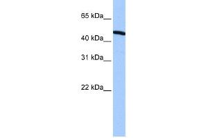 WB Suggested Anti-ZNF514 Antibody Titration:  0.