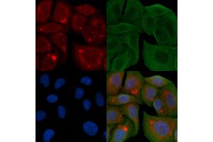 ABIN6258895 and ABIN6274392 staining Hela cells by IF/ICC. (FASTKD1 antibody  (Internal Region))