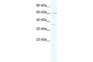 WB Suggested Anti-MTA1 Antibody Titration:  2. (MTA1 antibody  (Middle Region))