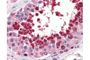 Immunohistochemistry (IHC) image for anti-Glutathione Peroxidase 4 (GPX4) (Middle Region) antibody (ABIN2787700) (GPX4 antibody  (Middle Region))