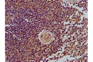 IHC image of ABIN7158045 diluted at 1:400 and staining in paraffin-embedded human spleen tissue performed on a Leica BondTM system. (LRPPRC antibody  (AA 901-1036))