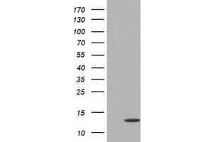 Western Blotting (WB) image for anti-Follicle Stimulating Hormone, beta Polypeptide (FSHB) antibody (ABIN1498320) (FSHB antibody)