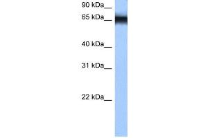 WB Suggested Anti-HNRPM Antibody Titration: 0. (HNRNPM antibody  (N-Term))