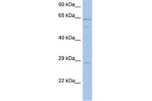 WB Suggested Anti-PRKAA1 Antibody Titration: 0. (PRKAA1 antibody  (Middle Region))
