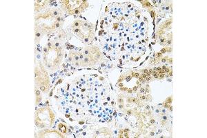 Immunohistochemistry of paraffin-embedded rat kidney using PNKP antibody (ABIN2564598) at dilution of 1:100 (40x lens). (PNKP antibody)