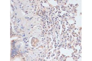 Immunohistochemistry of paraffin-embedded Rat lung using Phospho-STAT1(S727) Polyclonal Antibody at dilution of 1:100 (40x lens). (STAT1 antibody  (pSer727))