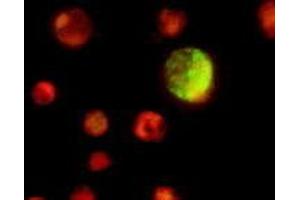 Immunofluorescence (IF) image for anti-Epstein-Barr Virus Viral Capsid Antigen gp110 (EBV VCA gp110) antibody (ABIN265548) (Epstein-Barr Virus Viral Capsid Antigen gp110 (EBV VCA gp110) antibody)