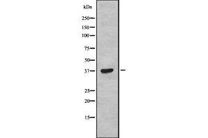Western blot analysis of TAS2R38 using COLO205 whole cell lysates (TAS2R38 antibody  (Internal Region))