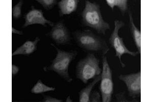 Immunofluorescent staining of HeLa (ATCC CCL-2) cells. (SKP1 antibody  (AA 4-158))