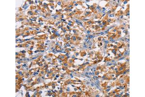 Immunohistochemistry (IHC) image for anti-Proto-Oncogene Pim-2 (Serine Threonine Kinase) (PIM2) antibody (ABIN2422823) (PIM2 antibody)