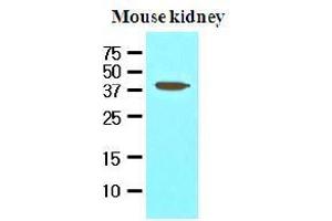 Western Blotting (WB) image for anti-Apoptosis, Caspase Activation Inhibitor (AVEN) (AA 254-362) antibody (ABIN336089) (AVEN antibody  (AA 254-362))