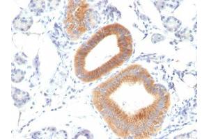 Image no. 1 for anti-CD86 (CD86) antibody (ABIN6185469) (CD86 antibody)