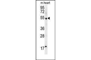 Western blot analysis of SCARA5 Antibody (C-term) Cat. (SCARA5 antibody  (C-Term))