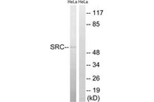 Western blot analysis of extracts from HeLa cells, treated with Hu 2nM 24h, using Src (Ab-75) Antibody. (Src antibody  (AA 41-90))