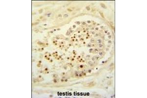 Formalin-fixed and paraffin-embedded human testis tissue reacted with CBLB Antibody (Center), which was peroxidase-conjugated to the secondary antibody, followed by DAB staining. (Cbl Proto-Oncogene B, E3 Ubiquitin Protein Ligase (CBLB) (AA 103-130) antibody)