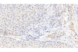 Detection of CRP in Human Liver Tissue using Monoclonal Antibody to C Reactive Protein (CRP) (CRP antibody  (AA 17-224))