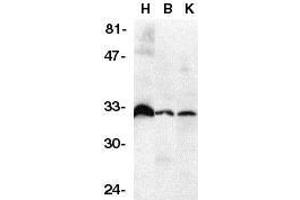Western blot analysis of DcR3 in human heart (H), brain (B), and kidney (K) tissue lysates with DcR3 antibody at 1μg/ml.