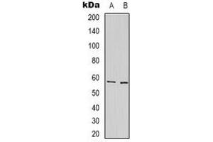 Western blot analysis of Prosaposin expression in HepG2 (A), NIH3T3 (B) whole cell lysates. (Prosaposin antibody)