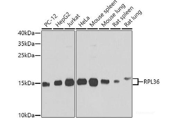 RPL36 antibody