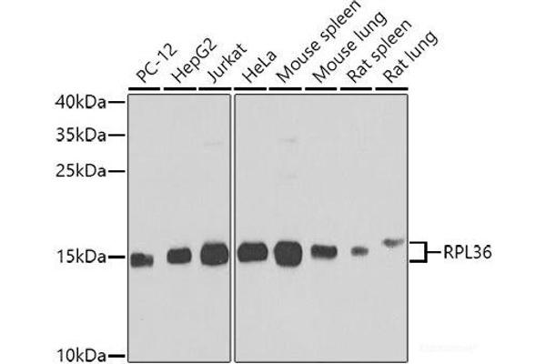 RPL36 antibody