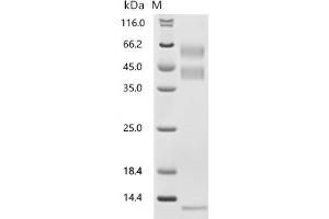 (Tris-Glycine gel) Discontinuous SDS-PAGE (reduced) with 5 % enrichment gel and 15 % separation gel.
